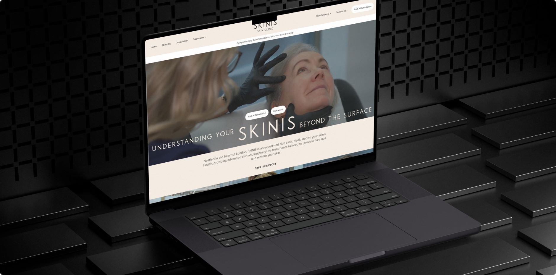 SKINIS